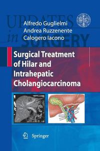 Cover image for Surgical Treatment of Hilar and Intrahepatic Cholangiocarcinoma