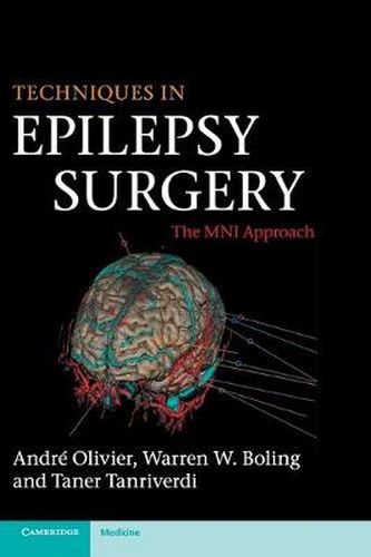 Cover image for Techniques in Epilepsy Surgery: The MNI Approach