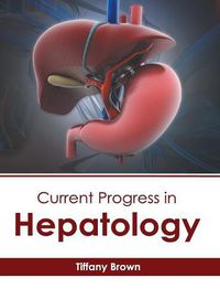 Cover image for Current Progress in Hepatology