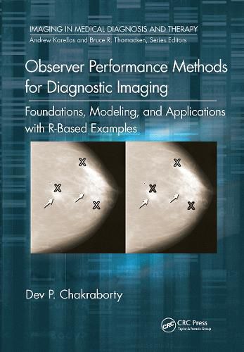 Cover image for Observer Performance Methods for Diagnostic Imaging: Foundations, Modeling, and Applications with R-Based Examples