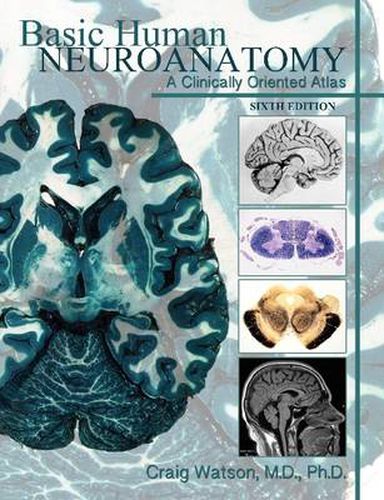 Cover image for Basic Human Neuroanatomy: A Clinically Oriented Atlas