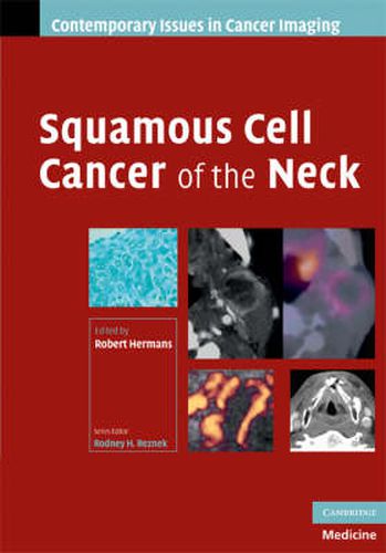 Cover image for Squamous Cell Cancer of the Neck