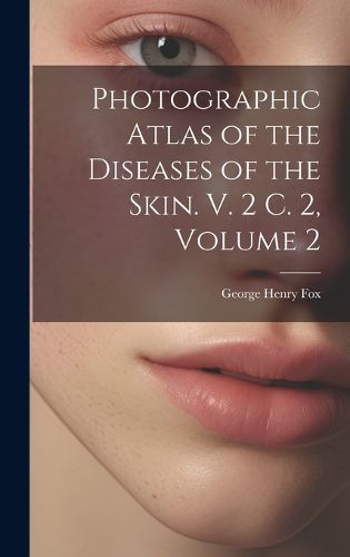 Photographic Atlas of the Diseases of the Skin. V. 2 C. 2, Volume 2