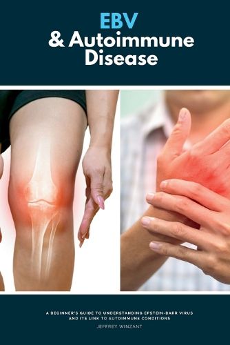 Cover image for EBV & Autoimmune Disease
