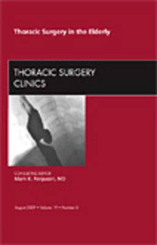 Cover image for Thoracic Surgery in the Elderly, An Issue of Thoracic Surgery Clinics