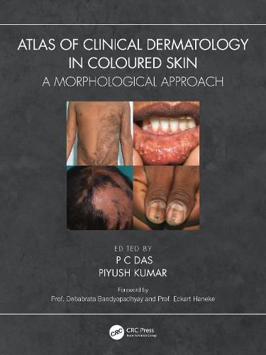 Cover image for Atlas of Clinical Dermatology in Coloured Skin: A Morphological Approach