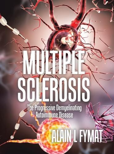 Cover image for Multiple Sclerosis