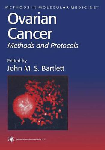 Cover image for Ovarian Cancer: Methods and Protocols