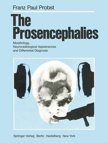 The Prosencephalies: Morphology, Neuroradiological Appearances and Differential Diagnosis