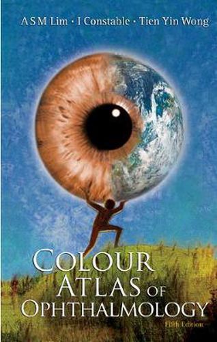 Cover image for Colour Atlas Of Ophthalmology (Fifth Edition)