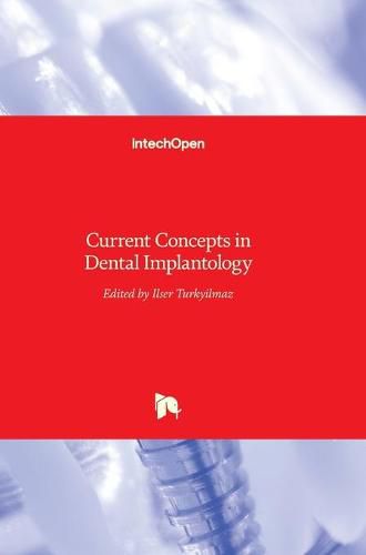 Cover image for Current Concepts in Dental Implantology