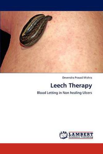 Cover image for Leech Therapy