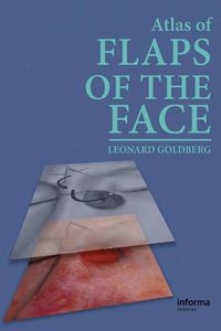 Cover image for Atlas of Flaps of the Face