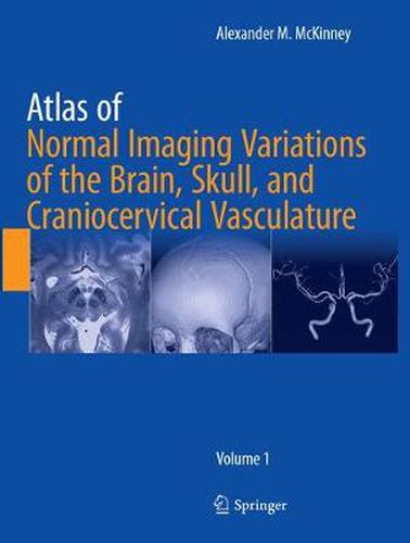 Cover image for Atlas of Normal Imaging Variations of the Brain, Skull, and Craniocervical Vasculature