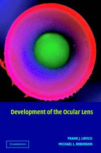 Cover image for Development of the Ocular Lens