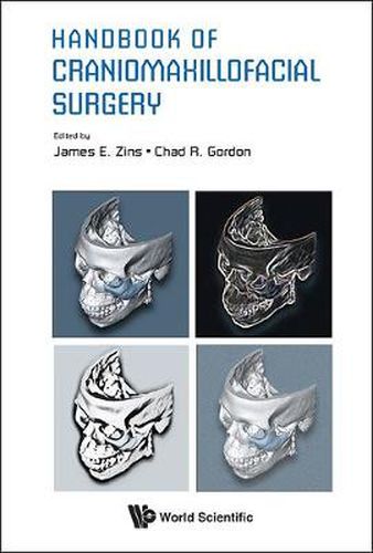 Cover image for Handbook Of Craniomaxillofacial Surgery