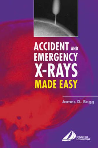 Cover image for Accident and Emergency X-Rays Made Easy