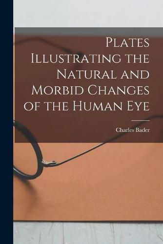 Cover image for Plates Illustrating the Natural and Morbid Changes of the Human Eye