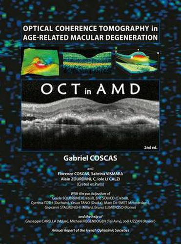Cover image for Optical Coherence Tomography in Age-Related Macular Degeneration