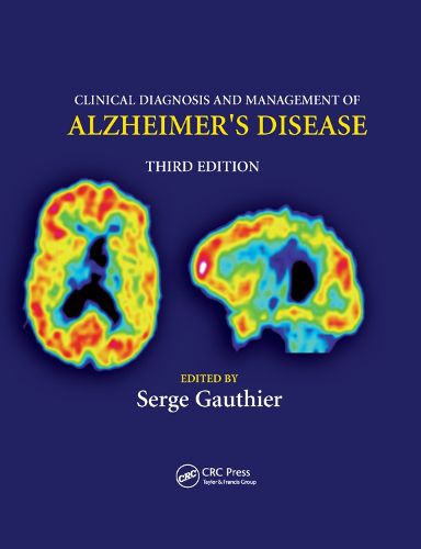 Cover image for Clinical Diagnosis and Management of Alzheimer's Disease