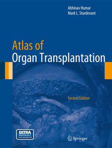 Cover image for Atlas of Organ Transplantation