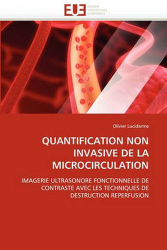 Cover image for Quantification Non Invasive de La Microcirculation