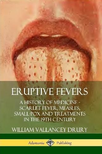 Cover image for Eruptive Fevers: A History of Medicine - Scarlet Fever, Measles, Small-Pox and Treatments in the 19th Century