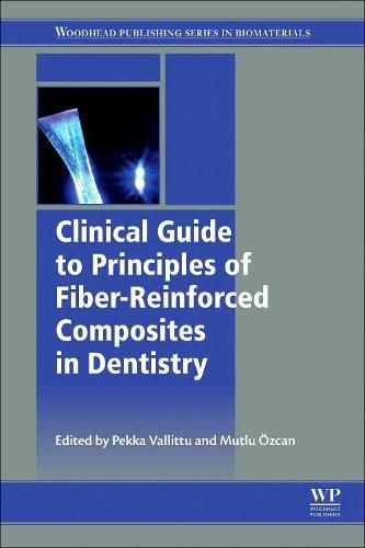 Clinical Guide to Principles of Fiber-Reinforced Composites in Dentistry