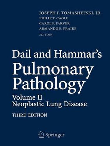 Cover image for Dail and Hammar's Pulmonary Pathology: Volume II: Neoplastic Lung Disease