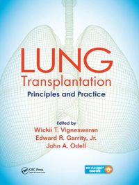 Cover image for LUNG Transplantation: Principles and Practice