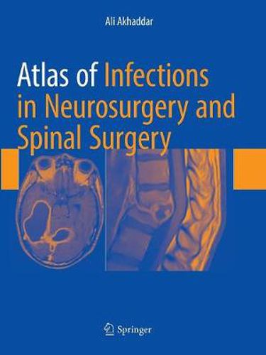 Cover image for Atlas of Infections in Neurosurgery and Spinal Surgery