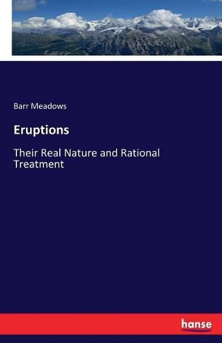 Cover image for Eruptions: Their Real Nature and Rational Treatment