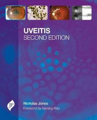 Cover image for Uveitis