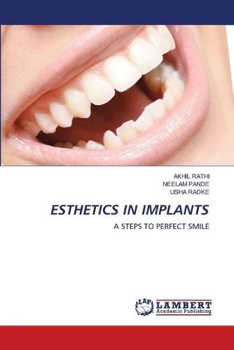 Cover image for Esthetics in Implants