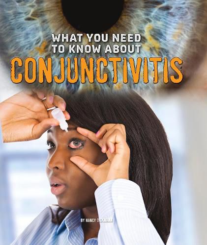 What You Need to Know about Conjunctivitis