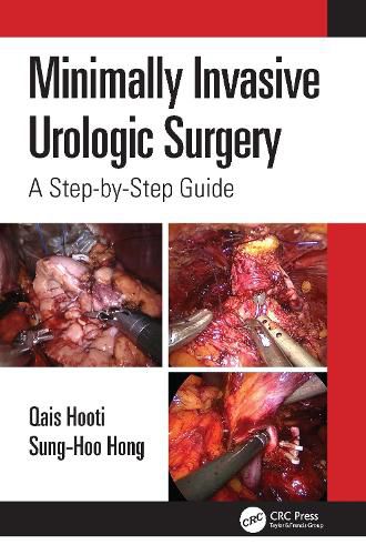 Cover image for Minimally Invasive Urologic Surgery: A Step-by-Step Guide