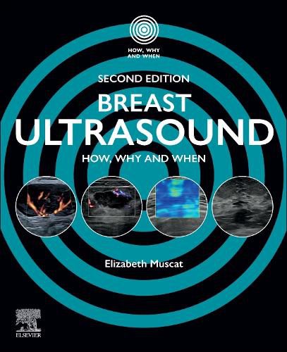 Cover image for Breast Ultrasound