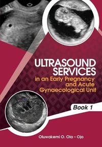 Cover image for Ultrasound Services in An Early Pregnancy and Acute Gynaecological Unit