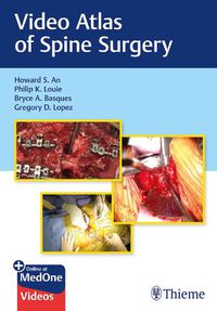 Cover image for Video Atlas of Spine Surgery