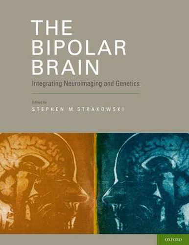 Cover image for The Bipolar Brain: Integrating Neuroimaging and Genetics