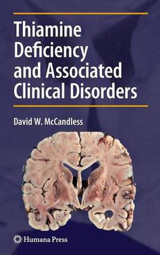 Thiamine Deficiency and Associated Clinical Disorders