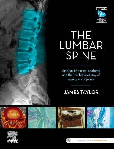 Cover image for The Lumbar Spine: An Atlas of Normal Anatomy and the Morbid Anatomy of Ageing and Injury