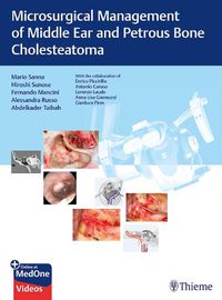 Cover image for Microsurgical Management of Middle Ear and Petrous Bone Cholesteatoma