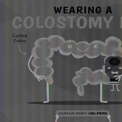 Wearing a Colostomy Bag