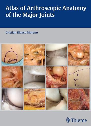 Cover image for Atlas of Arthroscopic Anatomy of the Major Joints