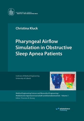 Cover image for Pharyngeal Airflow Simulation in Obstructive Sleep Apnea Patients