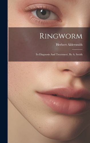 Cover image for Ringworm