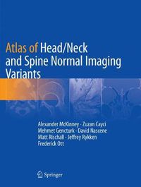 Cover image for Atlas of Head/Neck and Spine Normal Imaging Variants