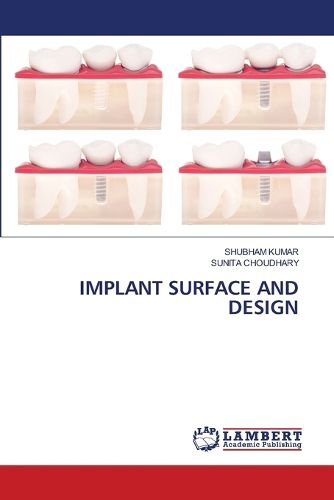 Cover image for Implant Surface and Design