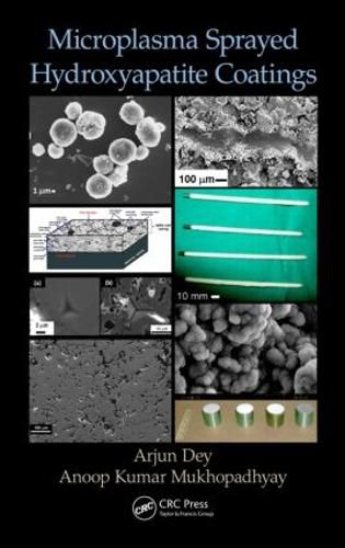 Cover image for Microplasma Sprayed Hydroxyapatite Coatings